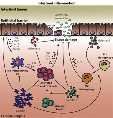 Galectins in Intestinal Inflammation: Galectin-1 Expression Delineates Response to Treatment in Celiac Disease Patients